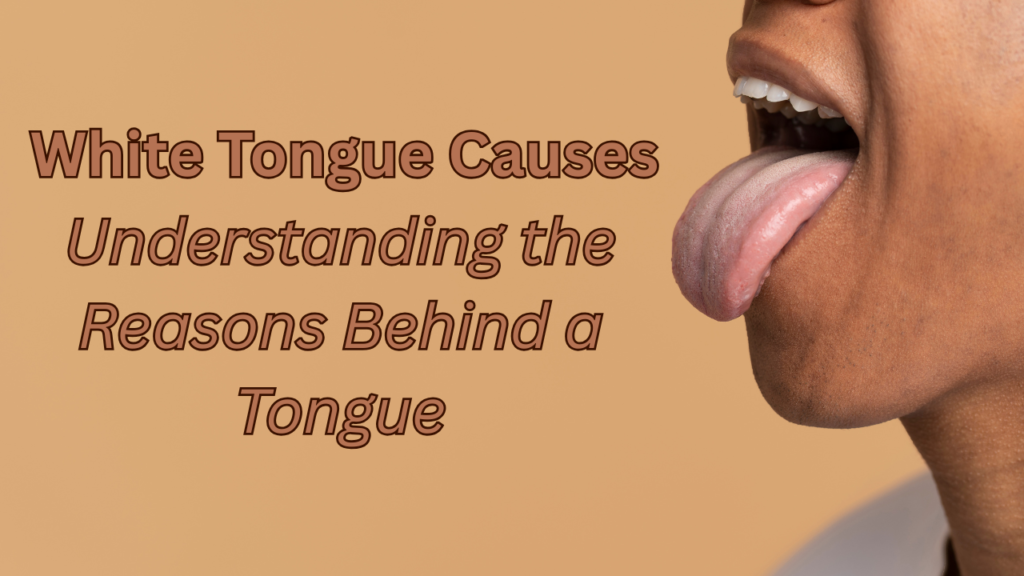 White Tongue Causes