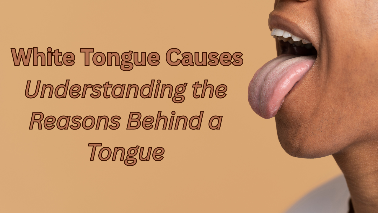 White Tongue Causes