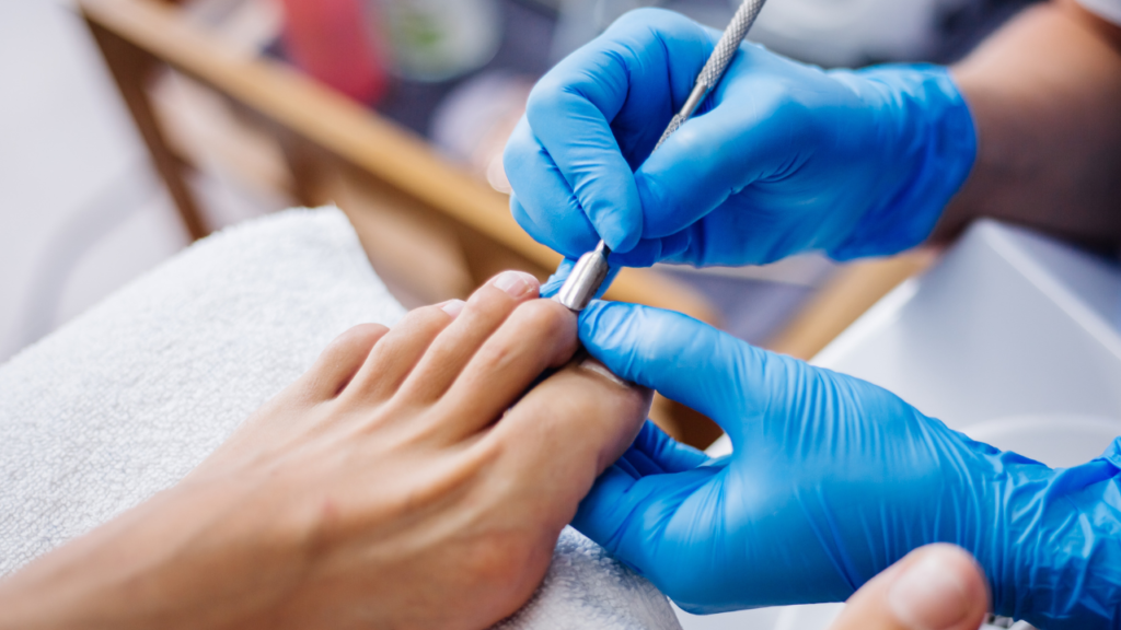 Best Nail Fungus Treatment