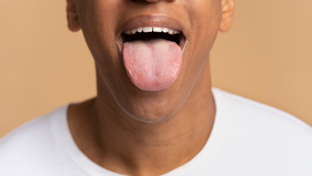 White Tongue Causes