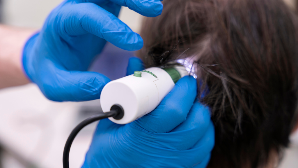 Hair Loss Treatment Cost